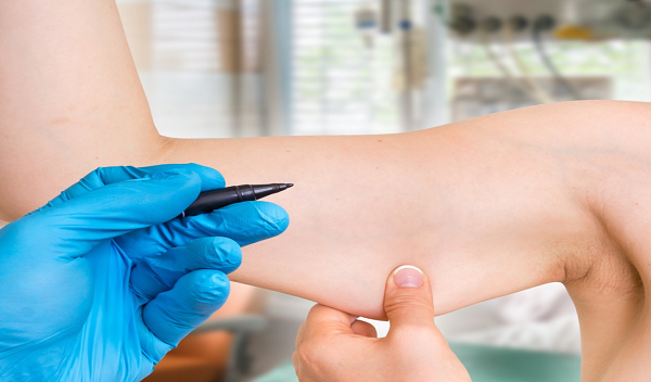 Arm Lift Surgery in Islamabad