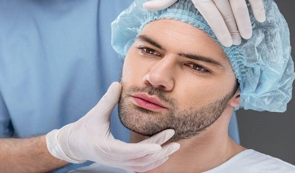 Beard hair transplant in Islamabad