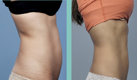  best Body Contouring in Islamabad