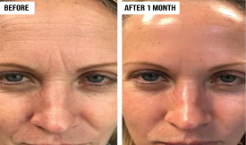 hydrafacial islamabad