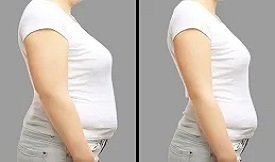Ozempic injections before after results