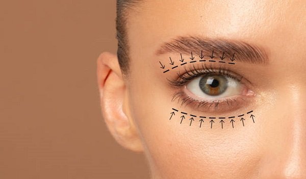 Eyelid Surgery in Islamabad