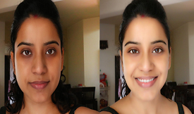 Best Skin whitening treatment in Islamabad