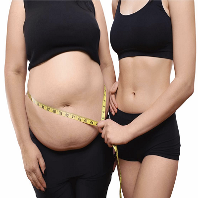 Fat Melting Injection Cost in Islamabad