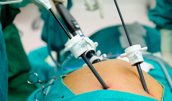 Bariatric Surgery in Islamabad