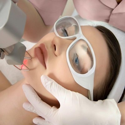 CO2 Fractional Laser Cost in Islamabad
