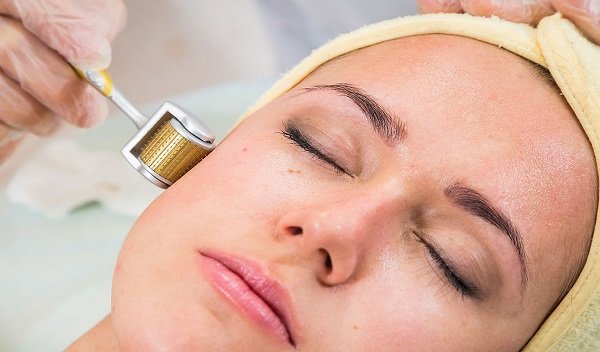 Derma Roller Treatment in Islamabad