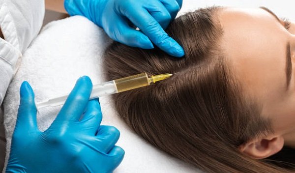 PRP hair treatment in Islamabad