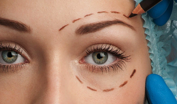 Blepharoplasty in Islamabad
