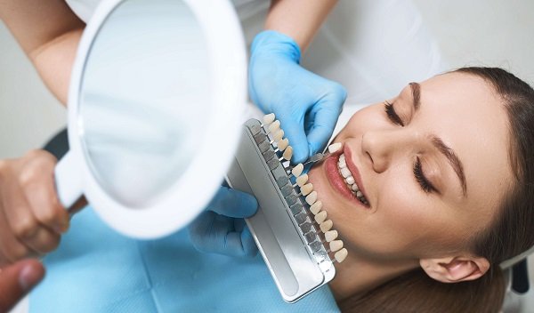 Composite Veneers in Islamabad