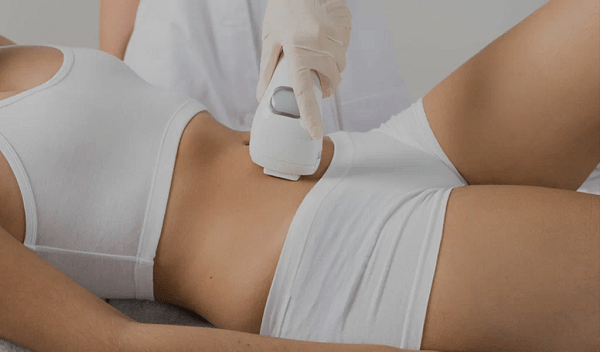Laser Liposuction in Islamabad