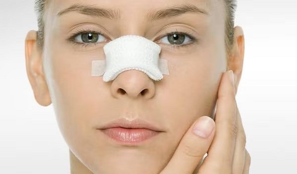 Septoplasty Surgery in Islamabad
