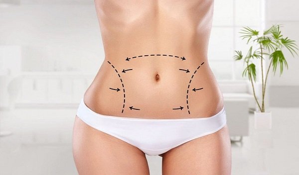 Vaser 4D Liposuction in Islamabad
