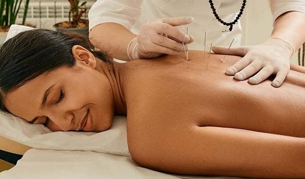 Acupuncture Treatment in Islamabad