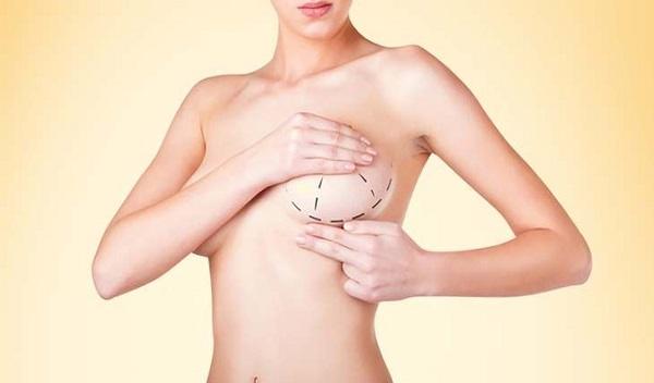 Breast Surgery in Islamabad