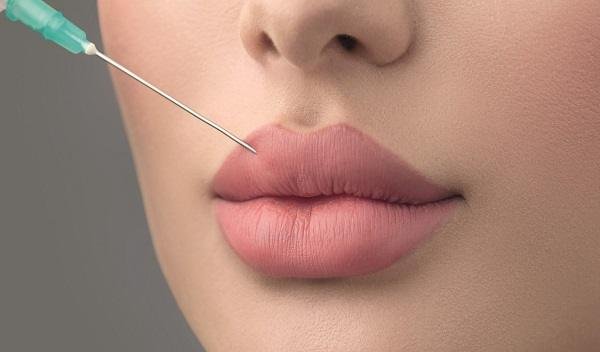 Russian Lip Fillers in Islamabad