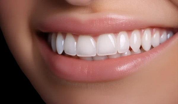 Hollywood Smile Design in Islamabad
