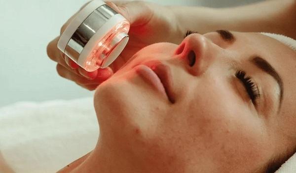 fractional Laser with PRP therapy in Islamabad